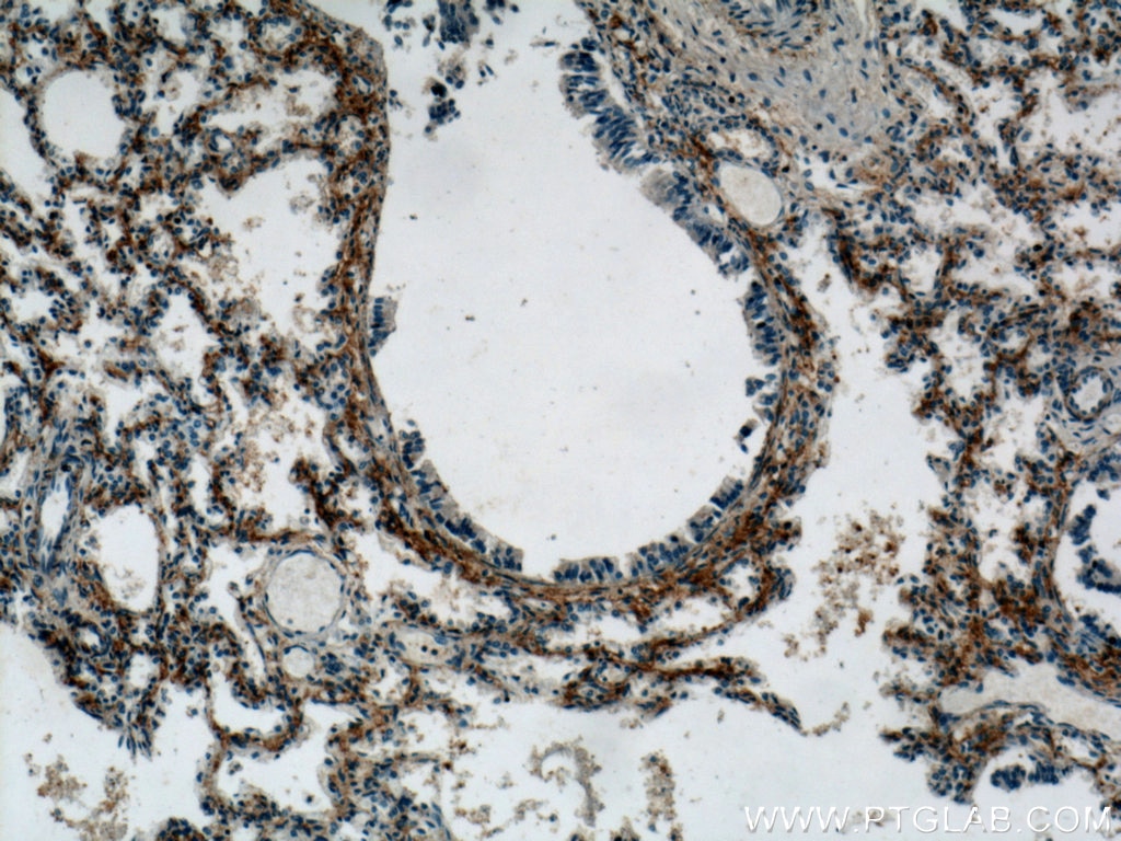 Immunohistochemistry (IHC) staining of human lung tissue using C5aR Polyclonal antibody (21316-1-AP)