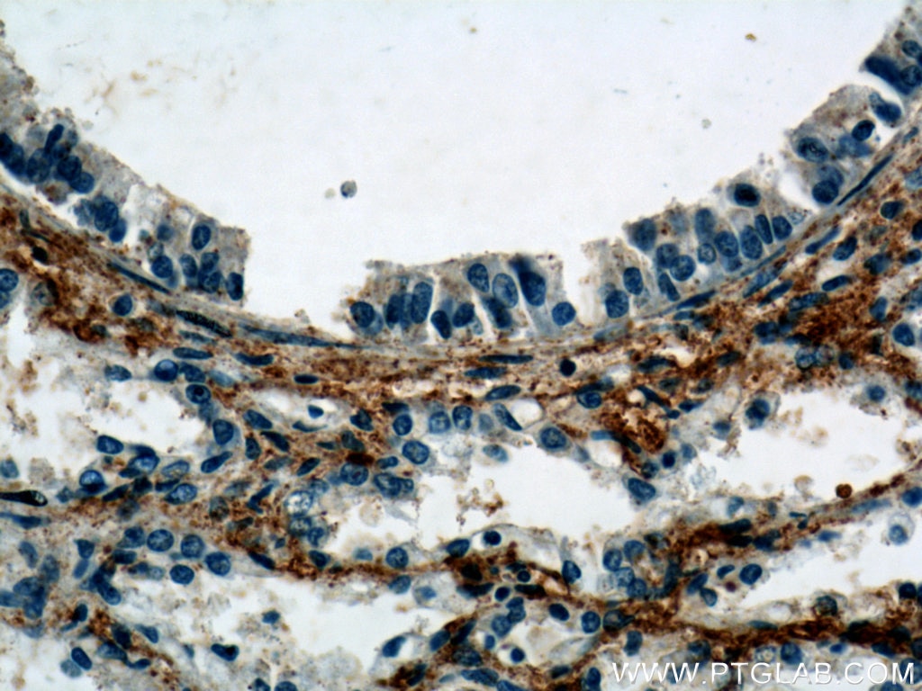 IHC staining of human lung using 21316-1-AP