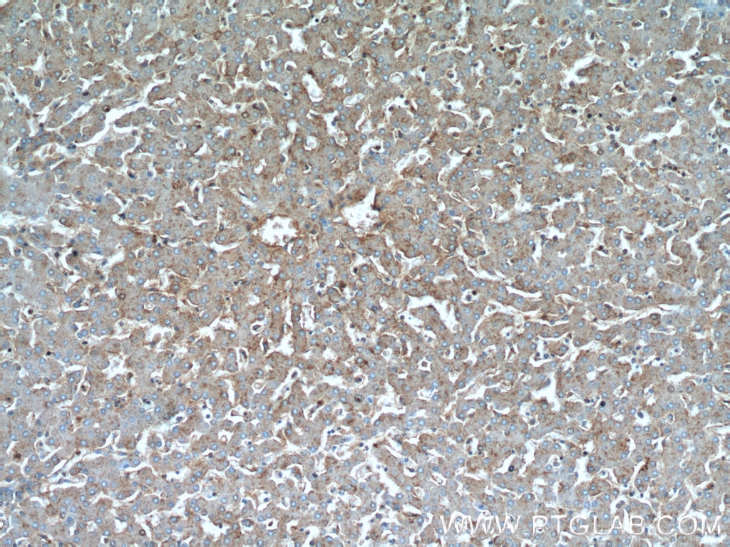 Immunohistochemistry (IHC) staining of human liver tissue using C5aR Polyclonal antibody (21316-1-AP)