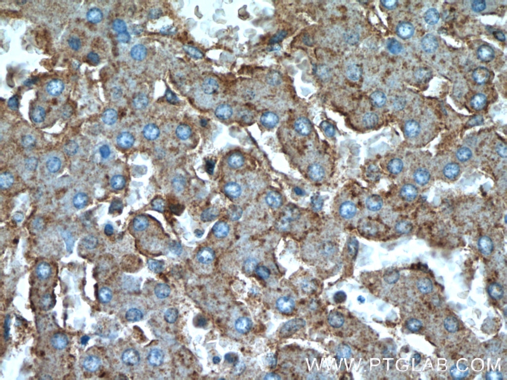 Immunohistochemistry (IHC) staining of human liver tissue using C5aR Polyclonal antibody (21316-1-AP)