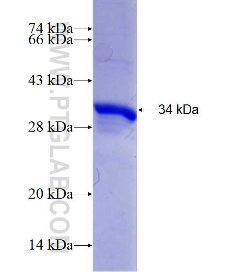 C5AR1 fusion protein Ag29140 SDS-PAGE