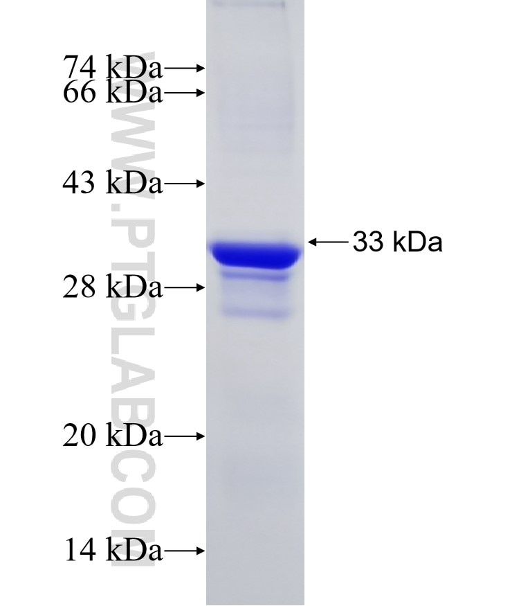 C5AR1 fusion protein Ag15968 SDS-PAGE