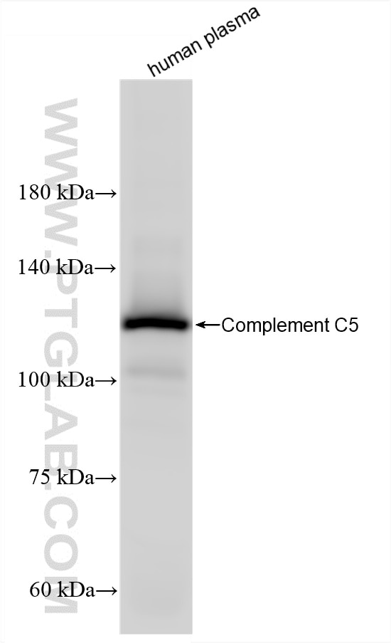 WB analysis of human plasma using 86463-4-RR (same clone as 86463-4-PBS) Western Blot (WB) analysis of human plasma using C5a Recombinant monoclonal antibody (86463-4-RR)