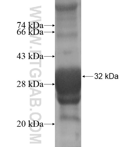 C5orf13 fusion protein Ag14010 SDS-PAGE