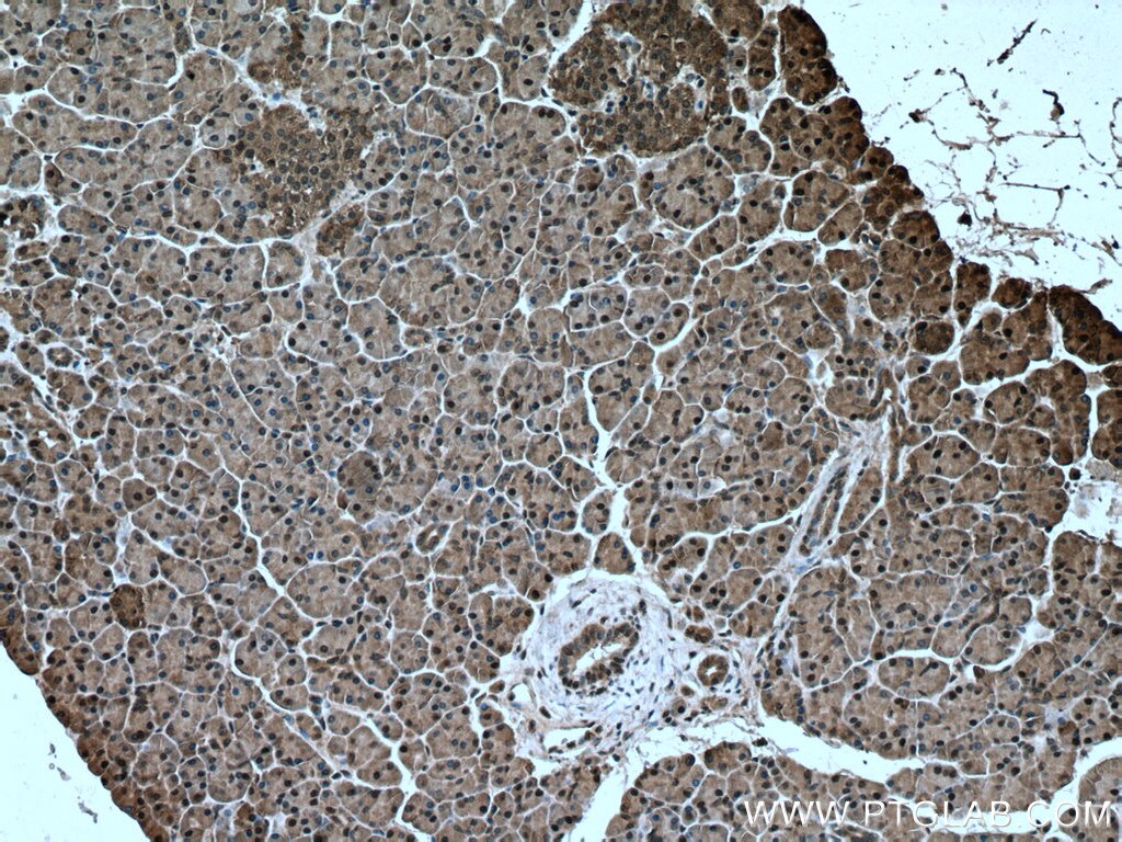 Immunohistochemistry (IHC) staining of human pancreas tissue using C5orf24 Polyclonal antibody (24319-1-AP)