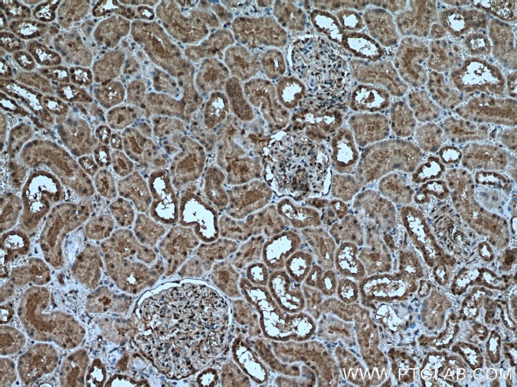 IHC staining of human kidney using 24319-1-AP