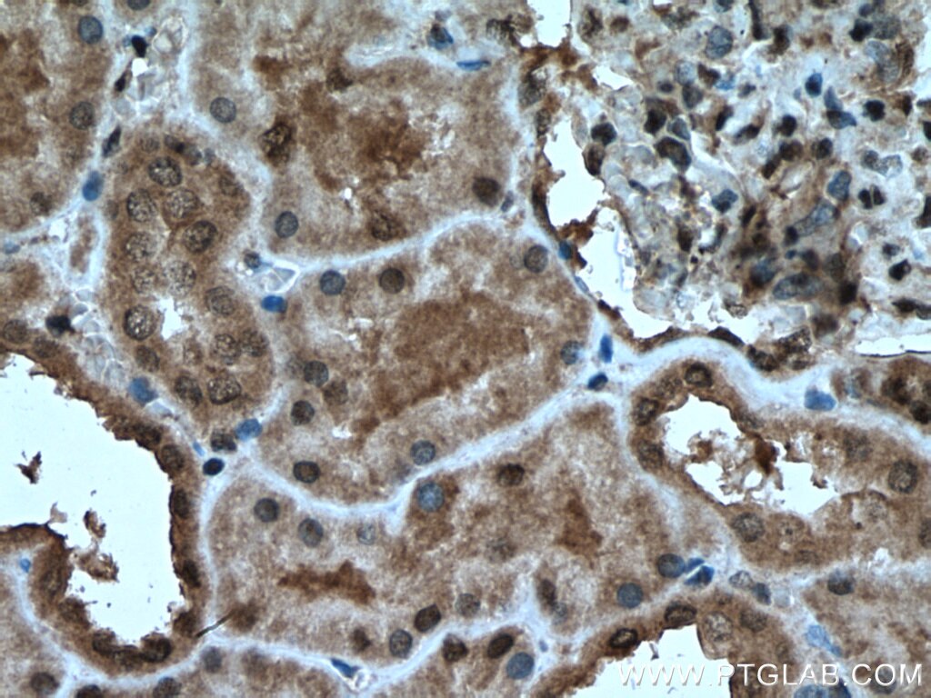 Immunohistochemistry (IHC) staining of human kidney tissue using C5orf24 Polyclonal antibody (24319-1-AP)