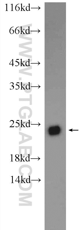 Western Blot (WB) analysis of HEK-293 cells using C5orf24 Polyclonal antibody (24319-1-AP)