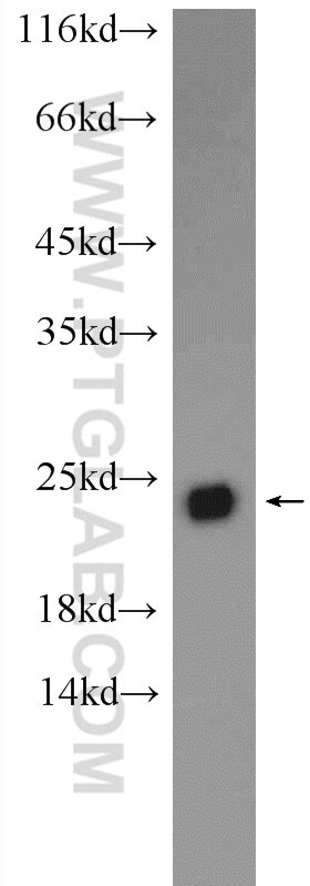 WB analysis of HEK-293 using 24319-1-AP