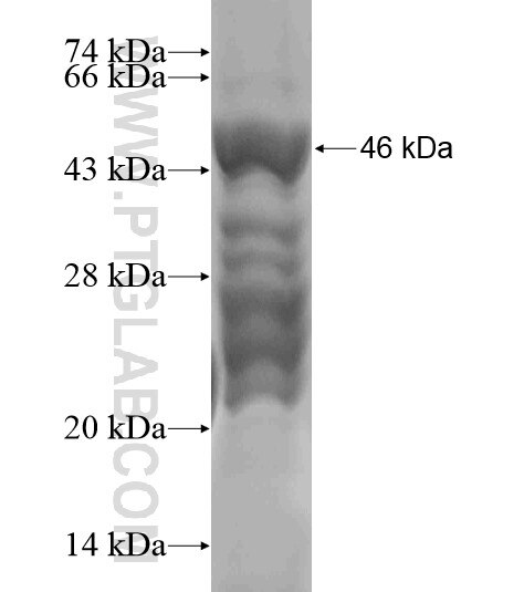 C5orf24 fusion protein Ag19534 SDS-PAGE