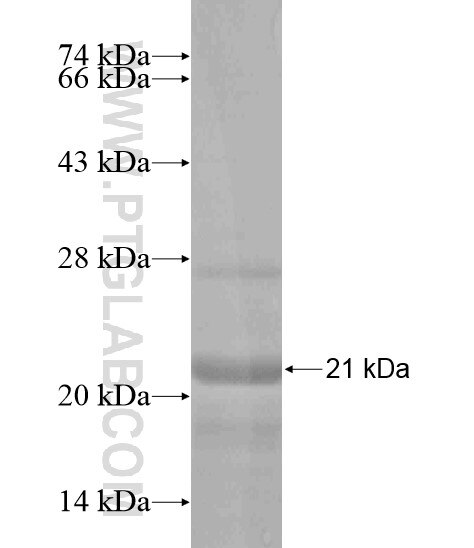 C5orf24 fusion protein Ag19660 SDS-PAGE