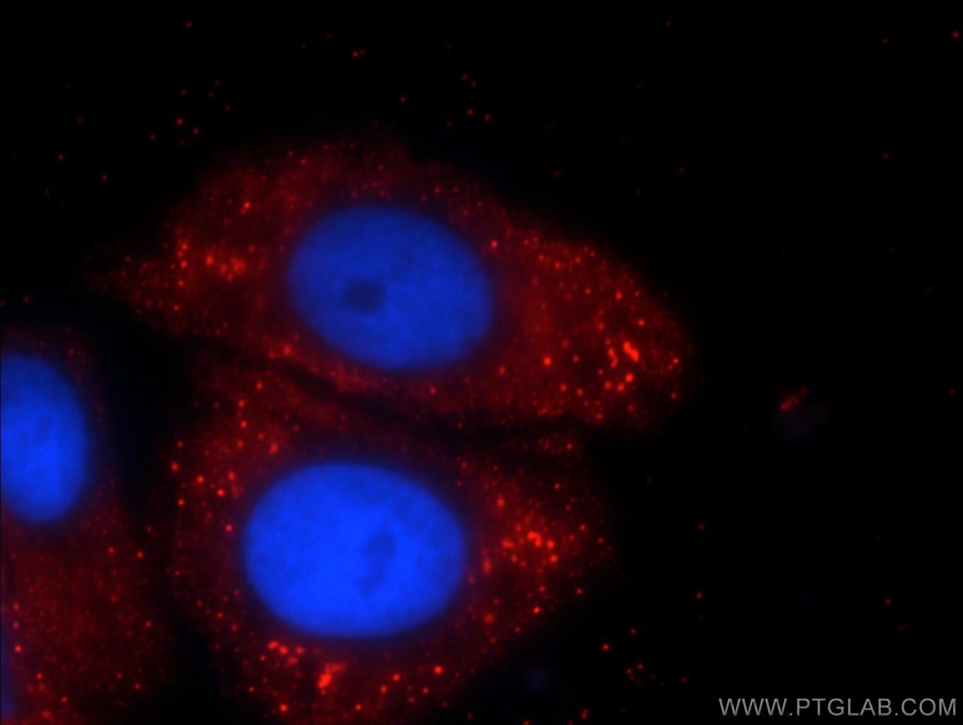 Immunofluorescence (IF) / fluorescent staining of HepG2 cells using C5orf26 Polyclonal antibody (24698-1-AP)