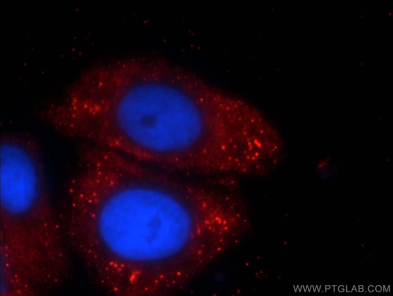 IF Staining of HepG2 using 24698-1-AP