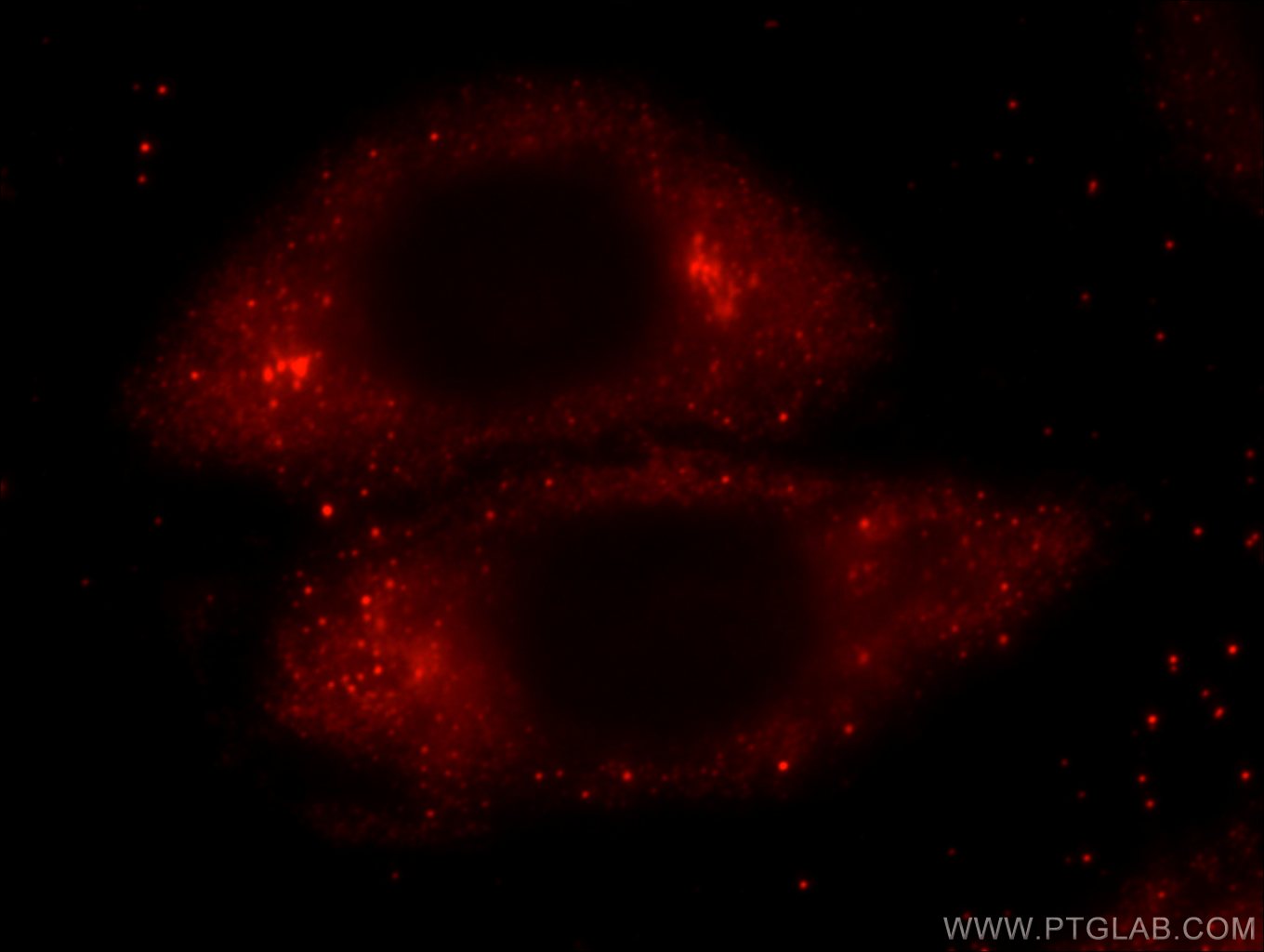Immunofluorescence (IF) / fluorescent staining of HeLa cells using C5orf26 Polyclonal antibody (24698-1-AP)