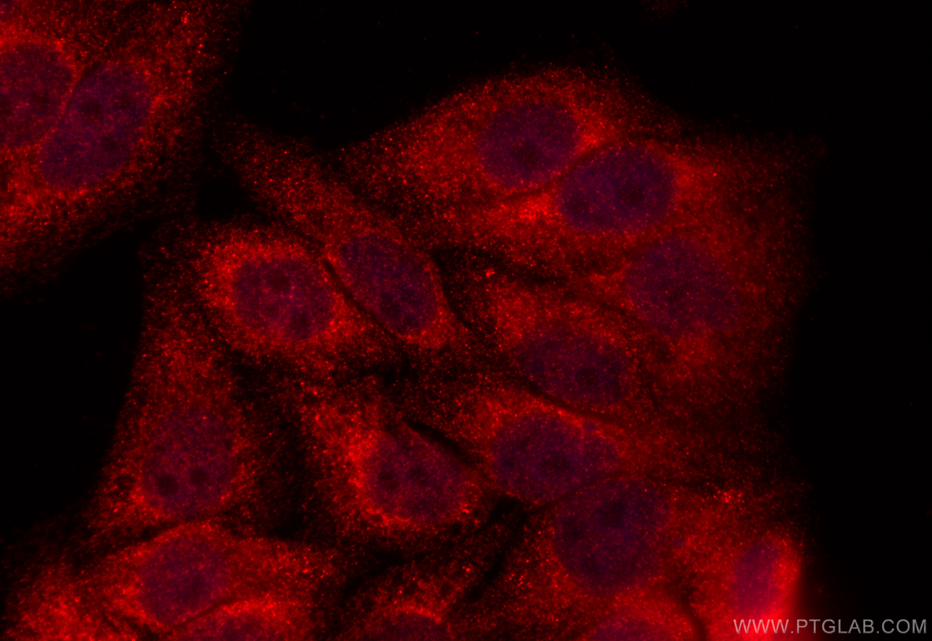 Immunofluorescence (IF) / fluorescent staining of HepG2 cells using C5orf26 Polyclonal antibody (24698-1-AP)