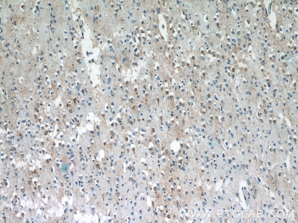 Immunohistochemistry (IHC) staining of human brain tissue using C5orf26 Polyclonal antibody (24698-1-AP)