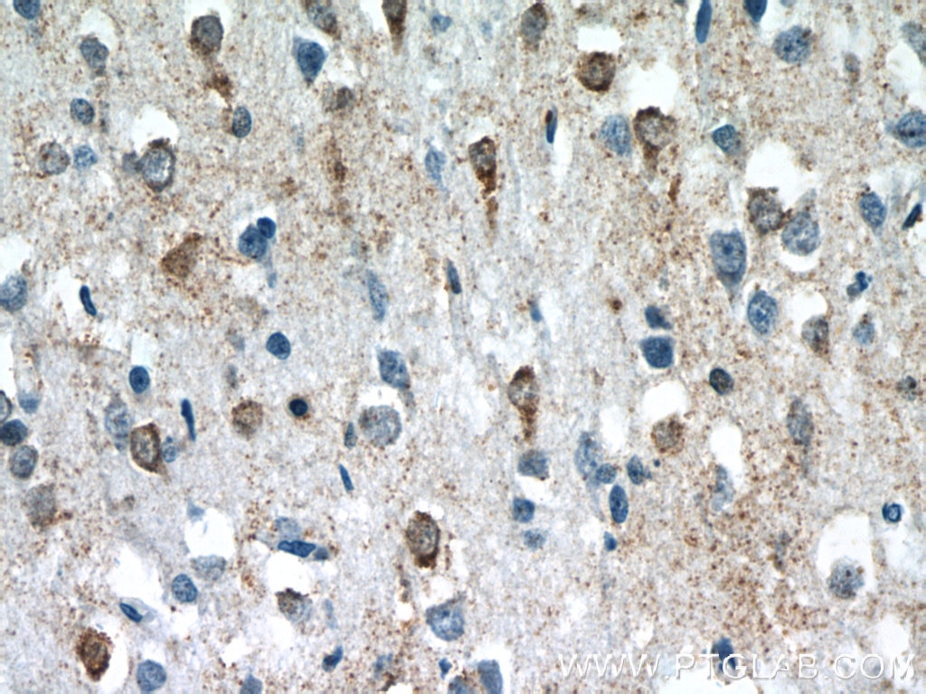 Immunohistochemistry (IHC) staining of human brain tissue using C5orf26 Polyclonal antibody (24698-1-AP)