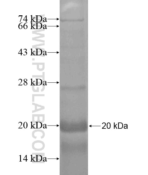 C5orf26 fusion protein Ag20367 SDS-PAGE