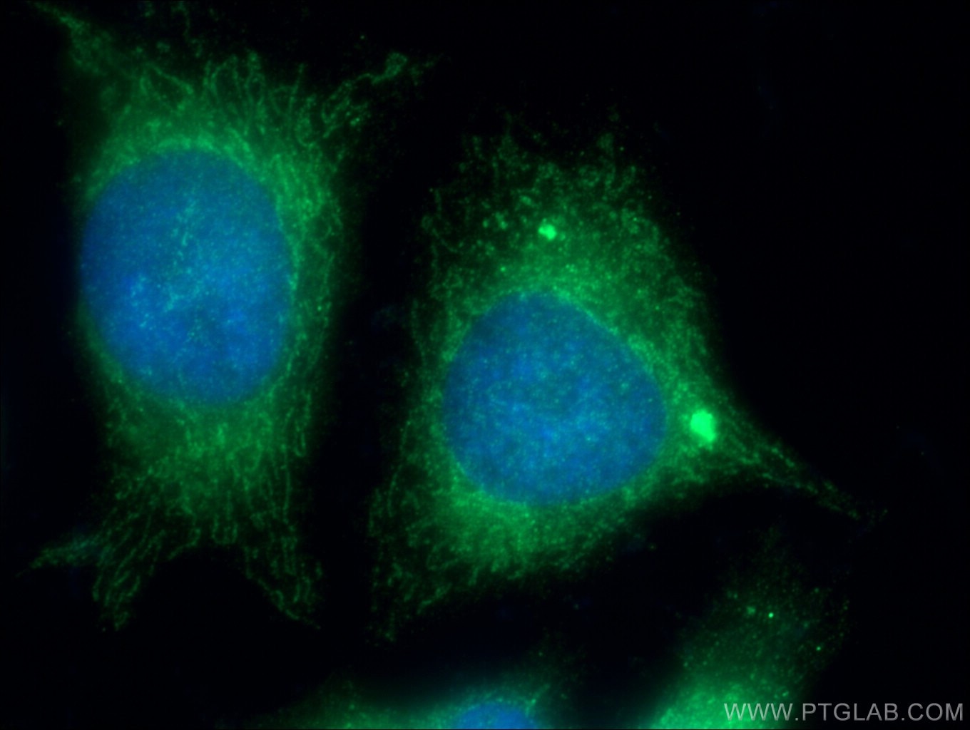 Immunofluorescence (IF) / fluorescent staining of HeLa cells using C5orf33 Polyclonal antibody (26352-1-AP)