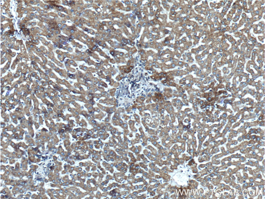 Immunohistochemistry (IHC) staining of human liver tissue using C5orf33 Polyclonal antibody (26352-1-AP)