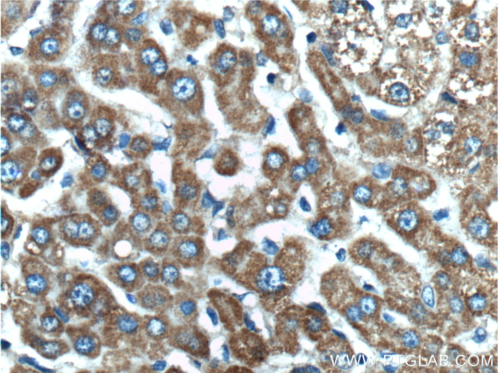 Immunohistochemistry (IHC) staining of human liver tissue using C5orf33 Polyclonal antibody (26352-1-AP)