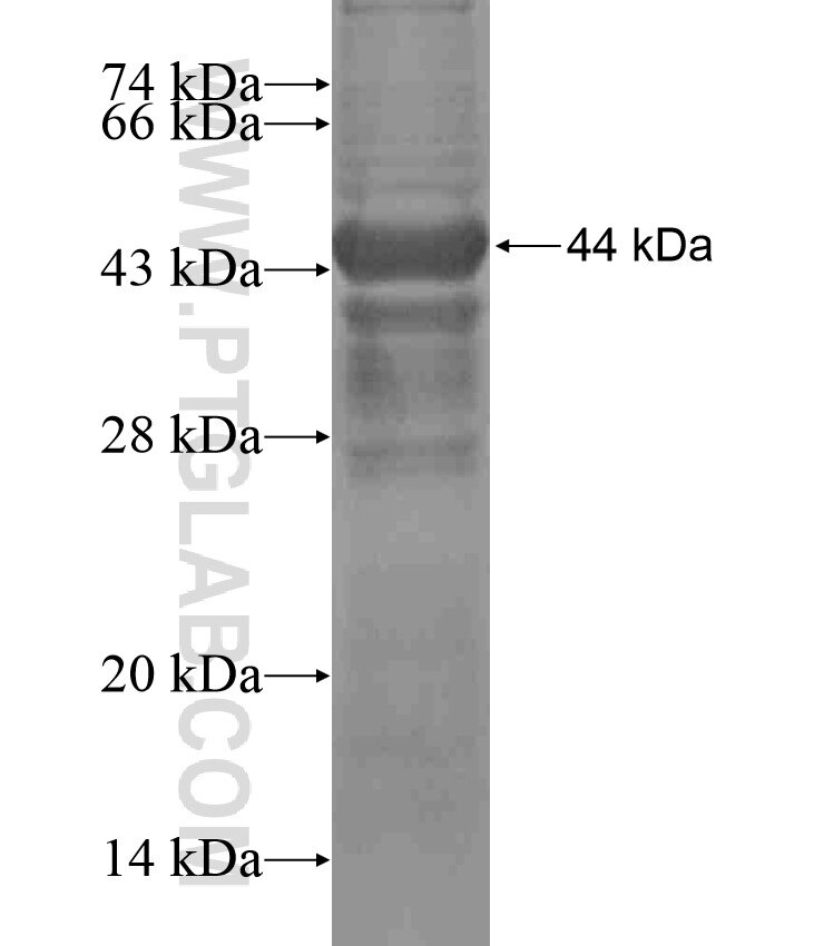 C5orf37 fusion protein Ag17060 SDS-PAGE