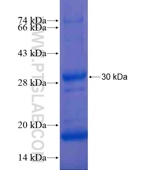 C5orf39 fusion protein Ag20807 SDS-PAGE