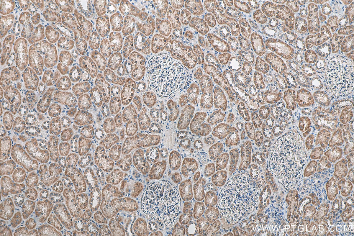 Immunohistochemistry (IHC) staining of human kidney tissue using C5orf4 Polyclonal antibody (22046-1-AP)