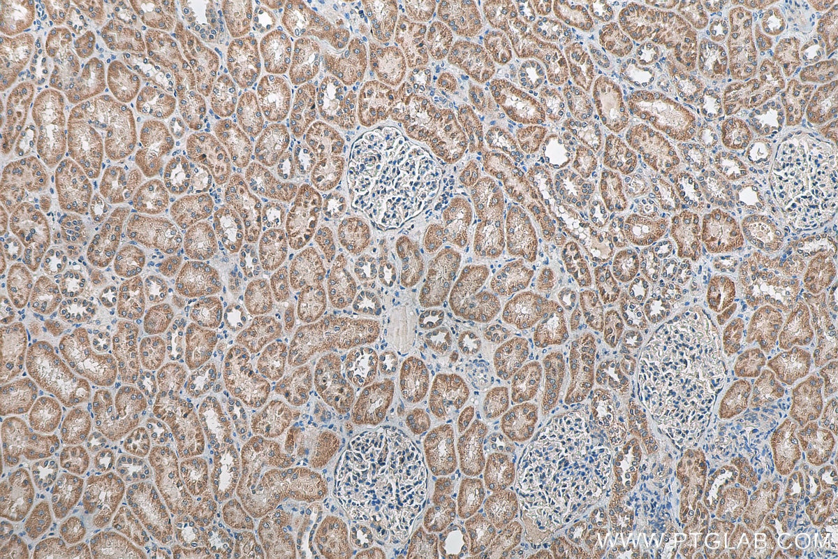 Immunohistochemistry (IHC) staining of human kidney tissue using C5orf4 Polyclonal antibody (22046-1-AP)