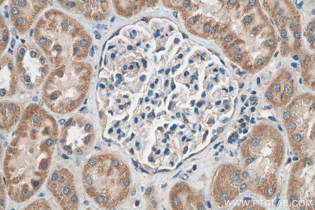 Immunohistochemistry (IHC) staining of human kidney tissue using C5orf4 Polyclonal antibody (22046-1-AP)