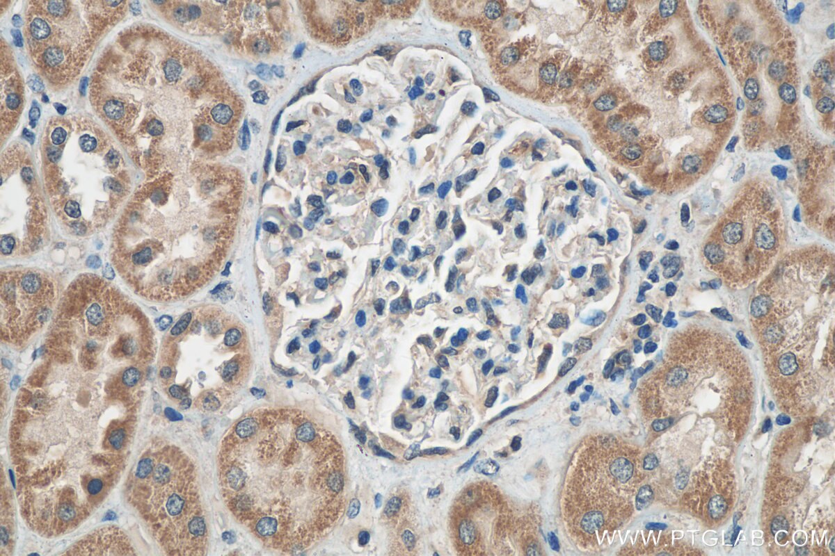 Immunohistochemistry (IHC) staining of human kidney tissue using C5orf4 Polyclonal antibody (22046-1-AP)