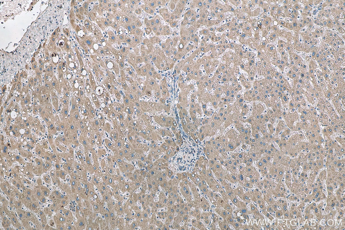 IHC staining of human liver using 22046-1-AP
