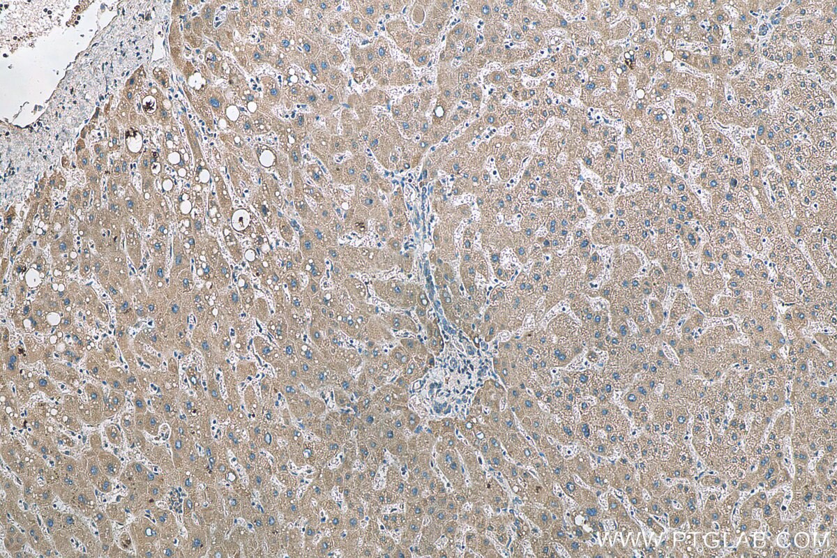 Immunohistochemistry (IHC) staining of human liver tissue using C5orf4 Polyclonal antibody (22046-1-AP)