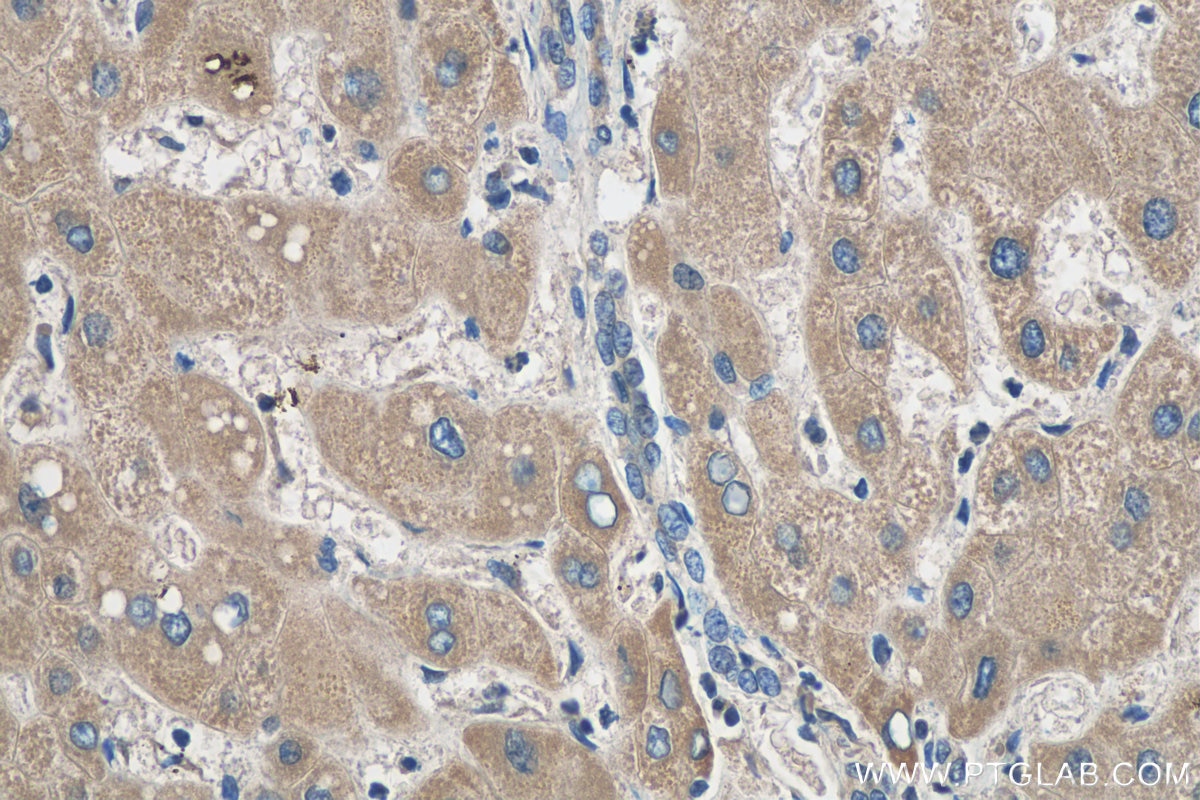 Immunohistochemistry (IHC) staining of human liver tissue using C5orf4 Polyclonal antibody (22046-1-AP)