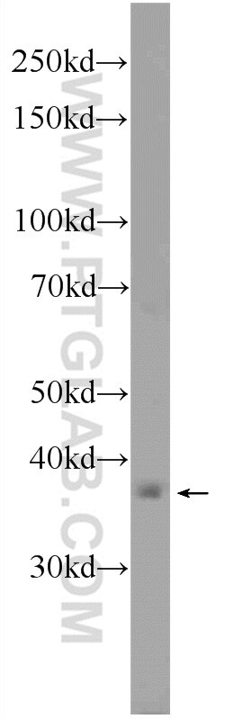 Western Blot (WB) analysis of A549 cells using C5orf4 Polyclonal antibody (22046-1-AP)