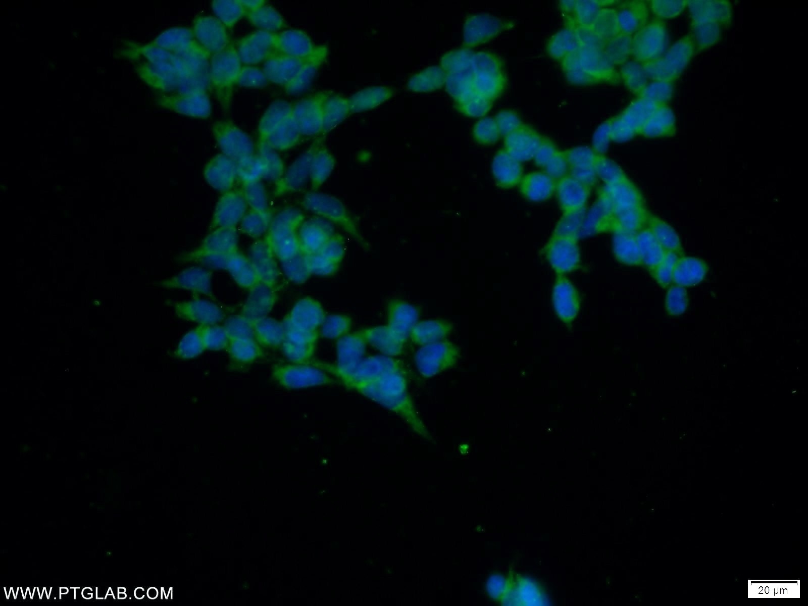 Immunofluorescence (IF) / fluorescent staining of HEK-293 cells using C5orf44 Polyclonal antibody (20444-1-AP)