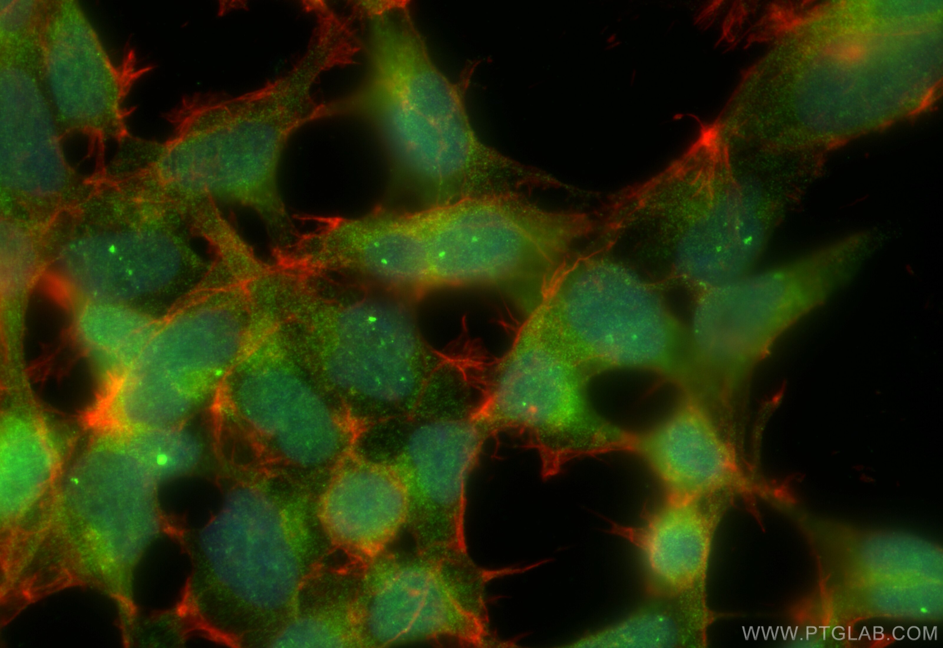 Immunofluorescence (IF) / fluorescent staining of HEK-293 cells using C5orf44 Polyclonal antibody (20444-1-AP)