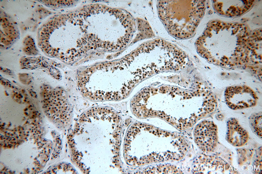 Immunohistochemistry (IHC) staining of human testis tissue using C5orf44 Polyclonal antibody (20444-1-AP)