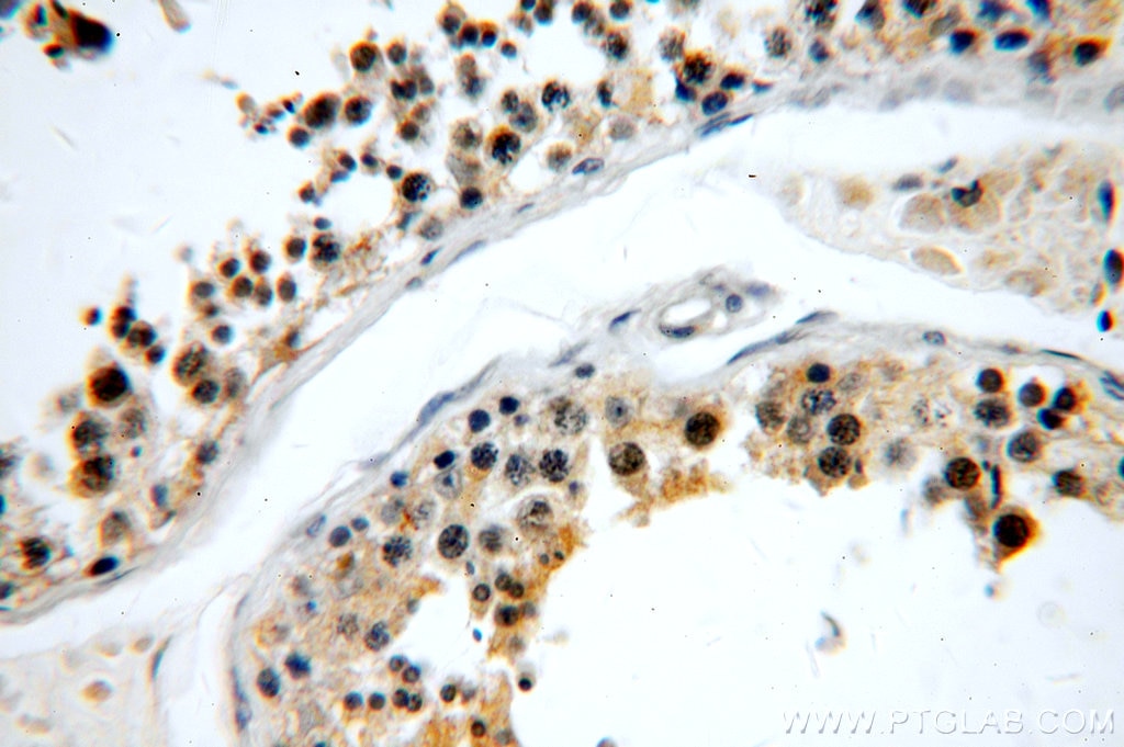 Immunohistochemistry (IHC) staining of human testis tissue using C5orf44 Polyclonal antibody (20444-1-AP)