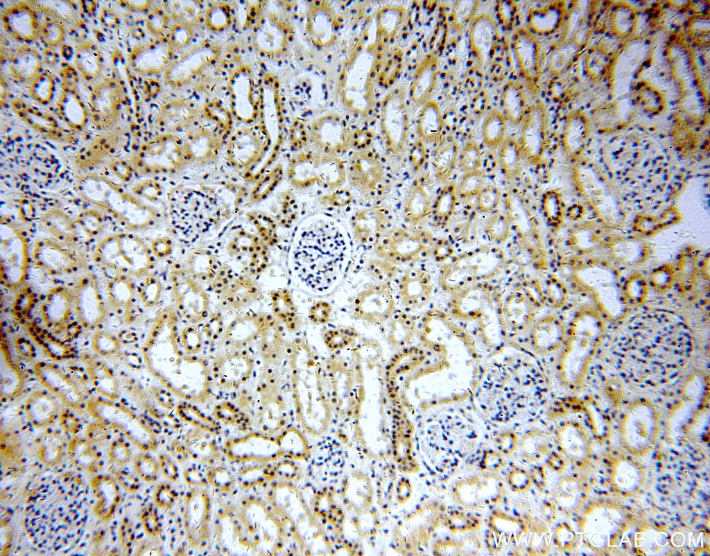 IHC staining of human kidney using 20444-1-AP