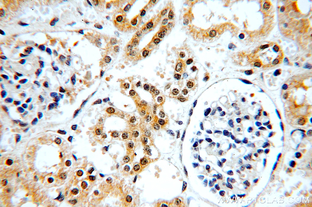 Immunohistochemistry (IHC) staining of human kidney tissue using C5orf44 Polyclonal antibody (20444-1-AP)
