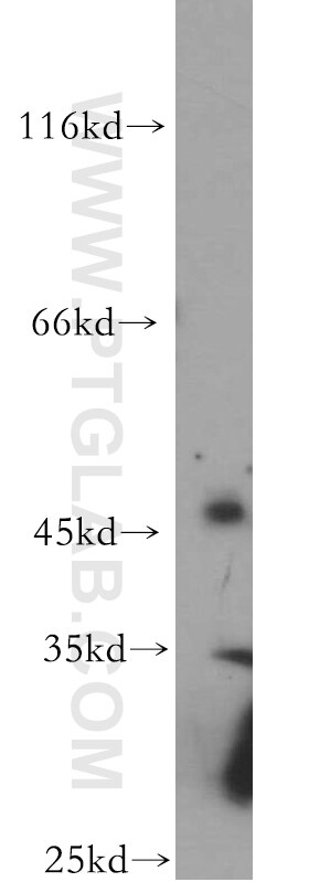 Western Blot (WB) analysis of HeLa cells using C5orf44 Polyclonal antibody (20444-1-AP)