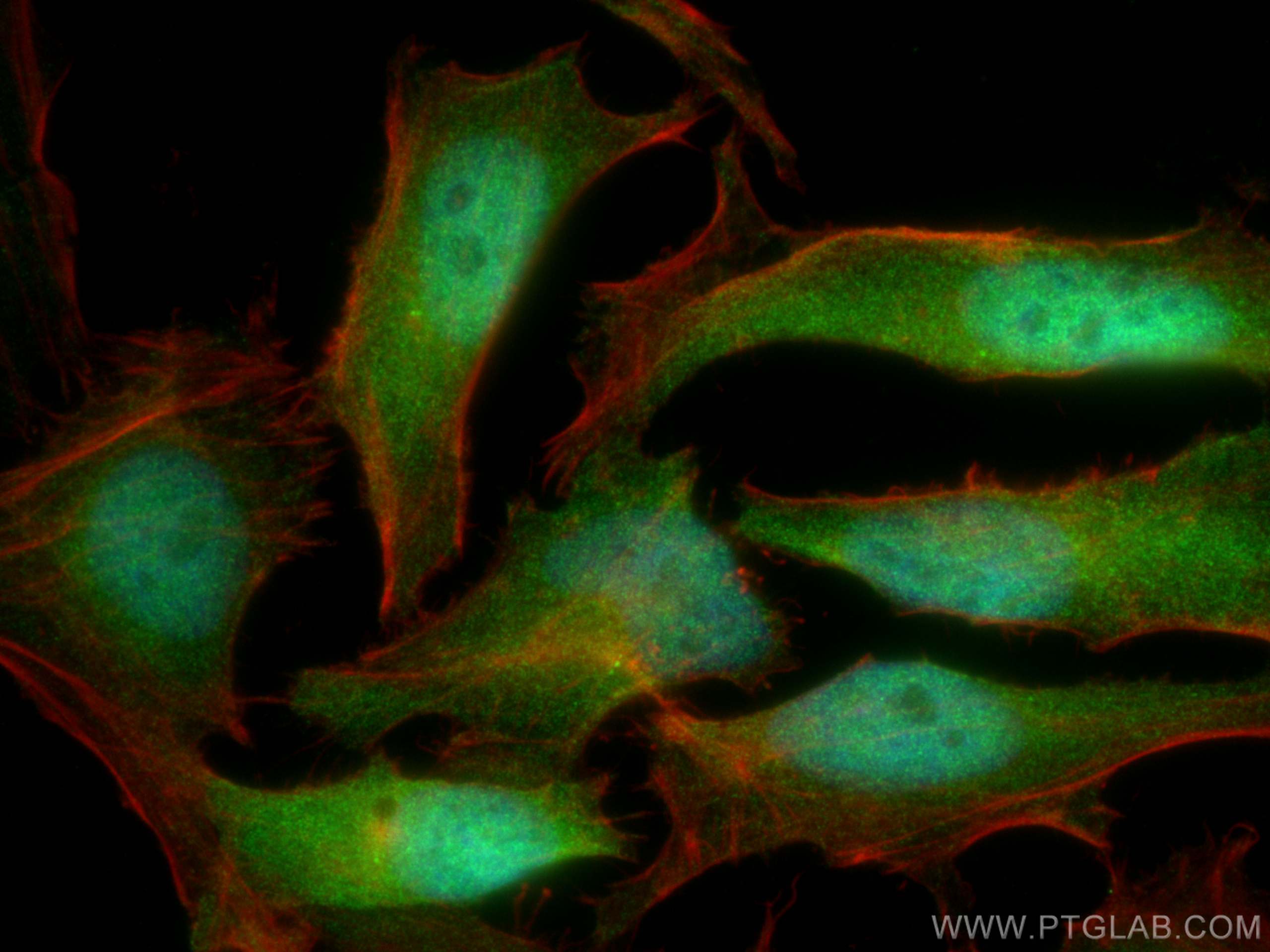 Immunofluorescence (IF) / fluorescent staining of HeLa cells using C5orf51 Polyclonal antibody (30107-1-AP)