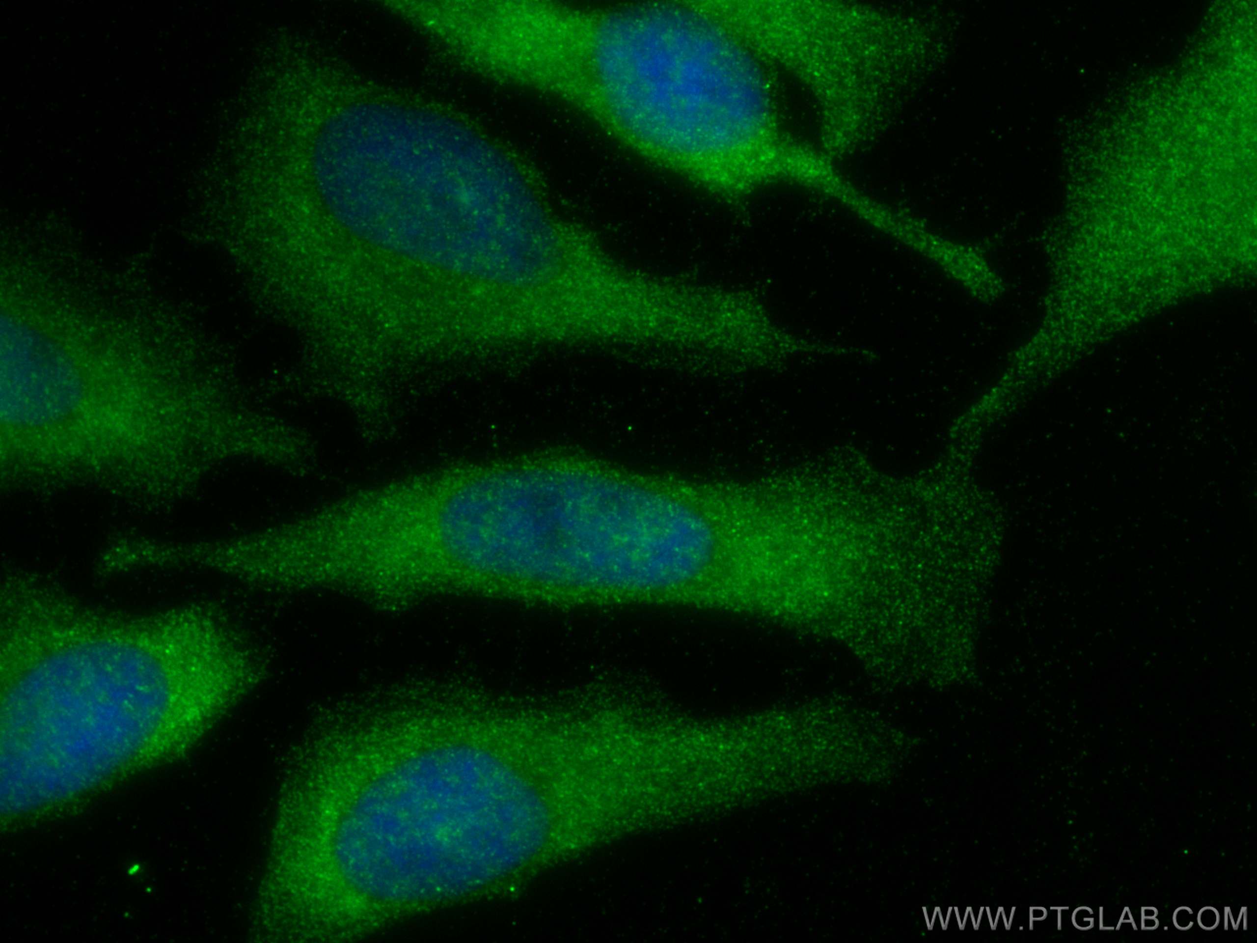 Immunofluorescence (IF) / fluorescent staining of HeLa cells using C5orf51 Polyclonal antibody (30107-1-AP)