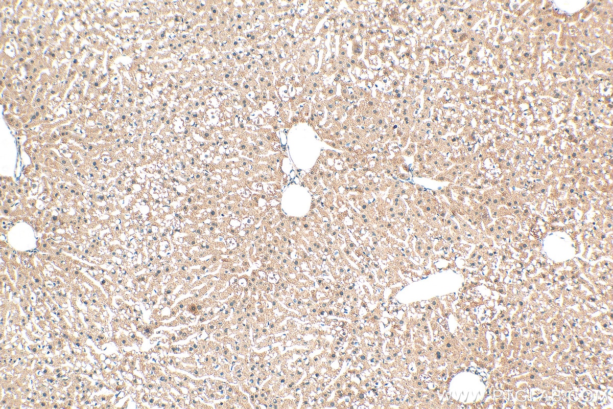 Immunohistochemistry (IHC) staining of mouse liver tissue using C5orf51 Polyclonal antibody (30107-1-AP)