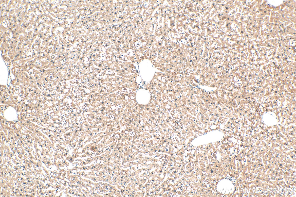 IHC staining of mouse liver using 30107-1-AP