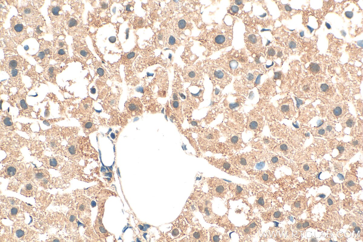 Immunohistochemistry (IHC) staining of mouse liver tissue using C5orf51 Polyclonal antibody (30107-1-AP)