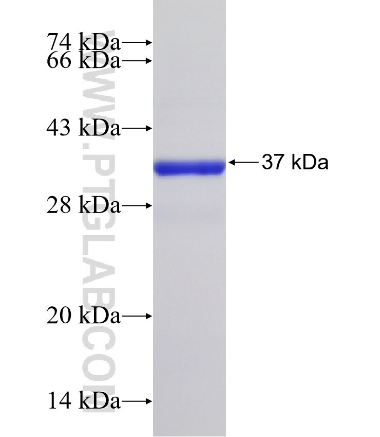 C5orf51 fusion protein Ag32440 SDS-PAGE