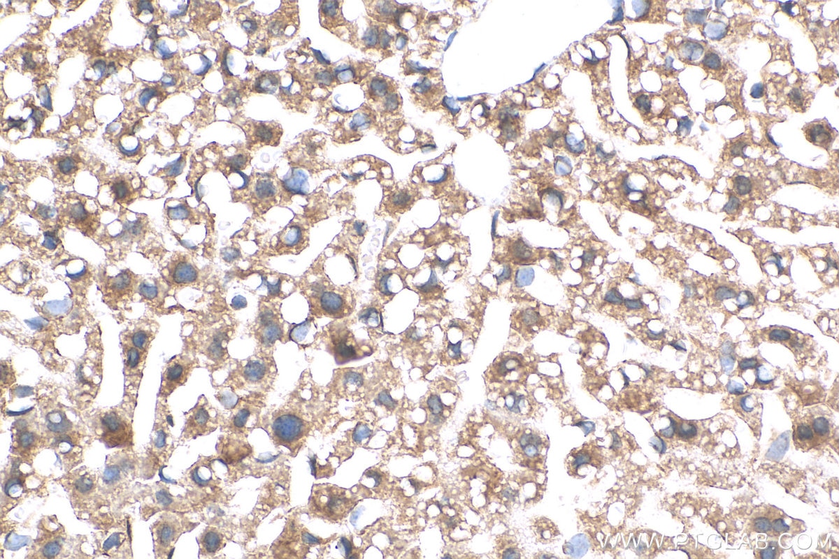 Immunohistochemistry (IHC) staining of mouse liver tissue using C6 Polyclonal antibody (17239-1-AP)