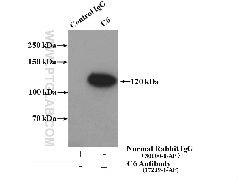 Immunoprecipitation (IP) experiment of human plasma using C6 Polyclonal antibody (17239-1-AP)